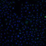 A549 +B8 Day 7, MitoTracker p-TBK1, 20X, 001 DAPI + p-TBK1