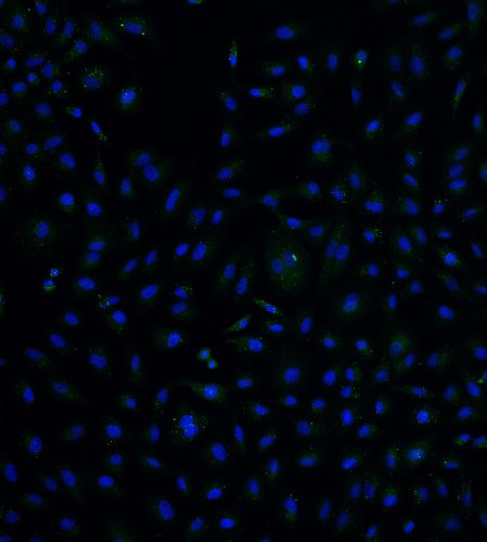 A549 +B8 Day 7, MitoTracker p-TBK1, 20X, 001 DAPI + p-TBK1